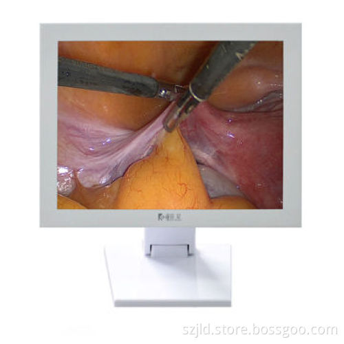 15" Endoscopic & Surgical Display, Display Anatomy, Radiate, Monitoring and Ultrasound Image